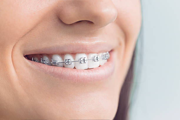 Best Traditional Braces  in Morton, MS